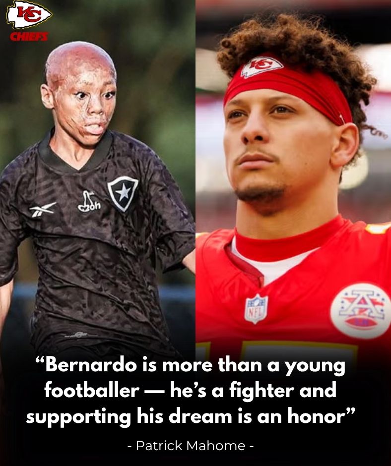 NFL star Patrick Mahomes shocked the world when he promised to pay for and stand by young burn survivor Bernardo Lopes. From transportation, special nutrition to future reconstructive surgeries, it will give him hope, strength and the chance to continue pursuing his football dream .q
